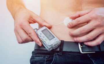 Insulin Pump Therapy